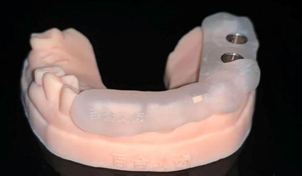 Celluloid-Tooth-Model-Surgical-Guide